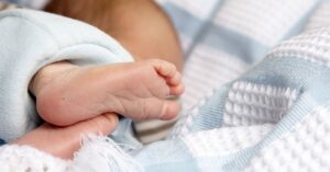 Mild, Moderate or Severe? How Long Your Baby Needs to Wear a Pigeon-Toe Brace